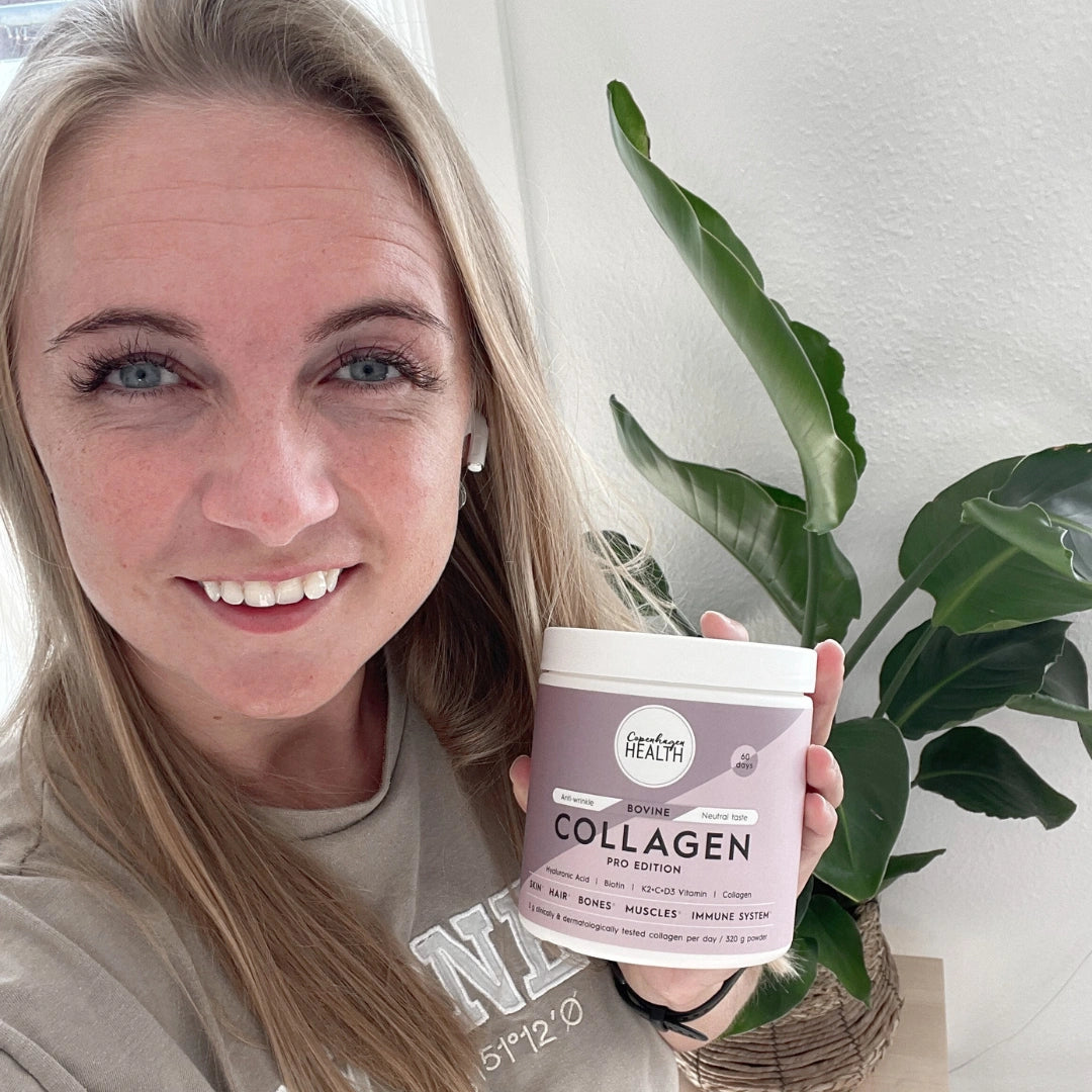 Kvinne smiler. Kollagen reduserer rynker og fine linjer